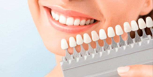 Aclaramiento En Dientes Vitales – Dened